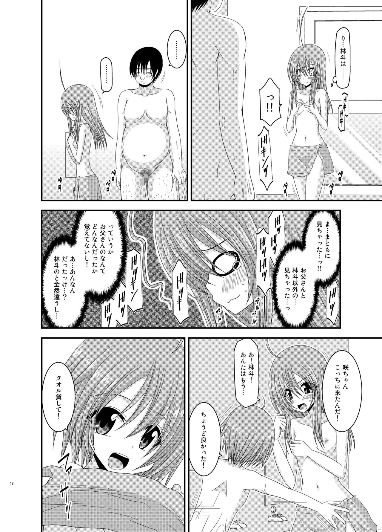 [valssu (茶琉)] 露出少女日記総集編2冊目 [DL版]