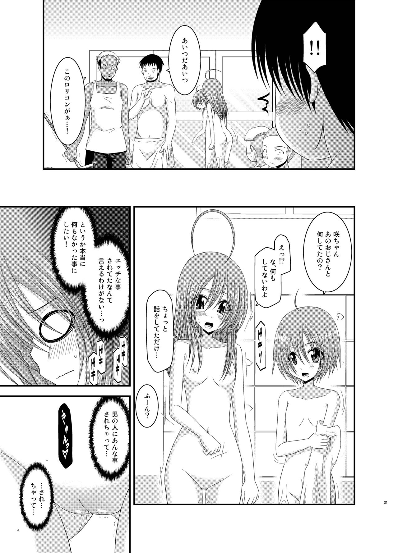 [valssu (茶琉)] 露出少女日記総集編2冊目 [DL版]