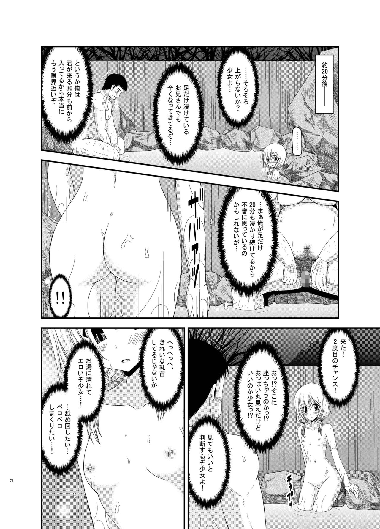 [valssu (茶琉)] 露出少女日記総集編2冊目 [DL版]