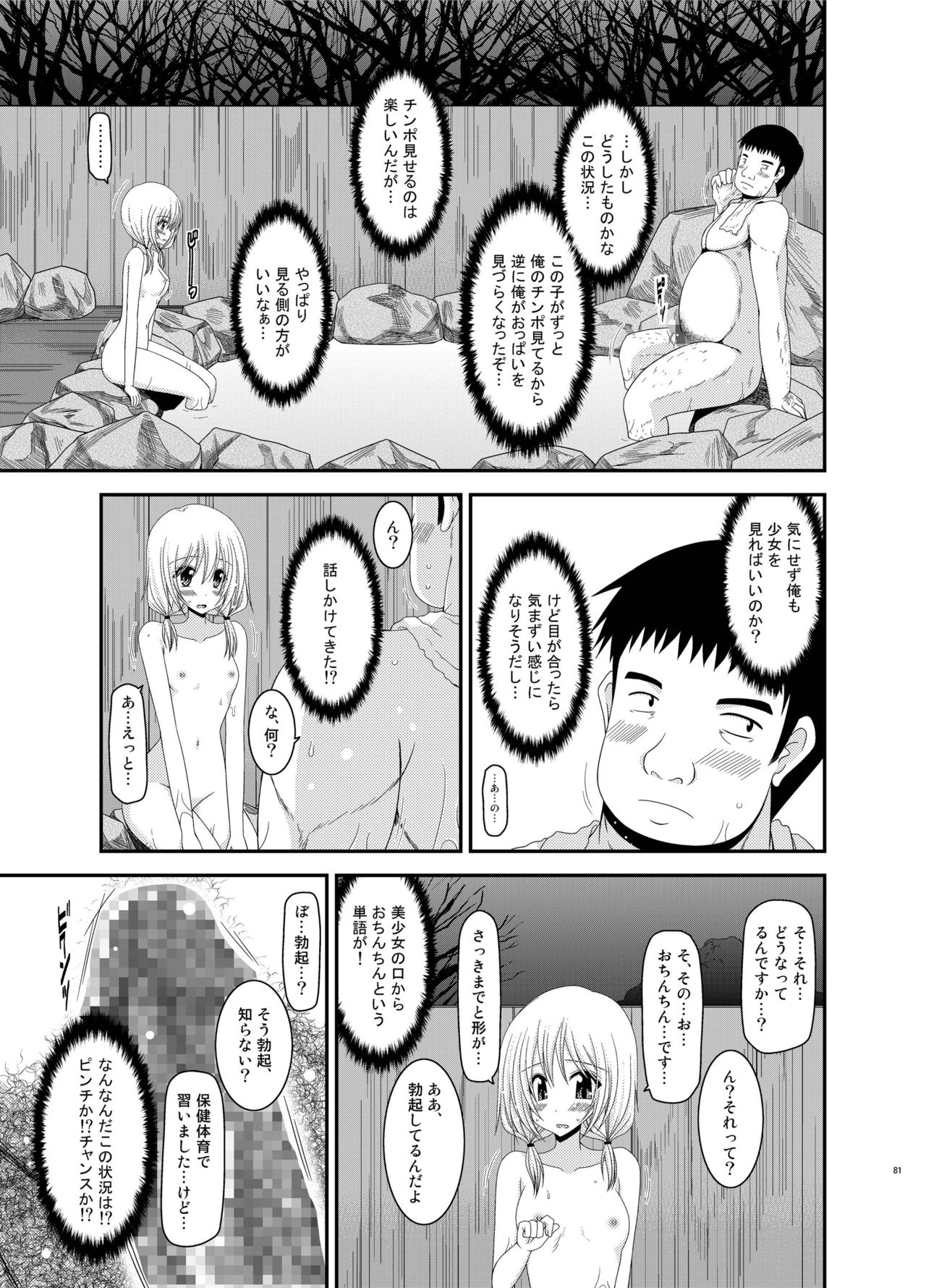 [valssu (茶琉)] 露出少女日記総集編2冊目 [DL版]