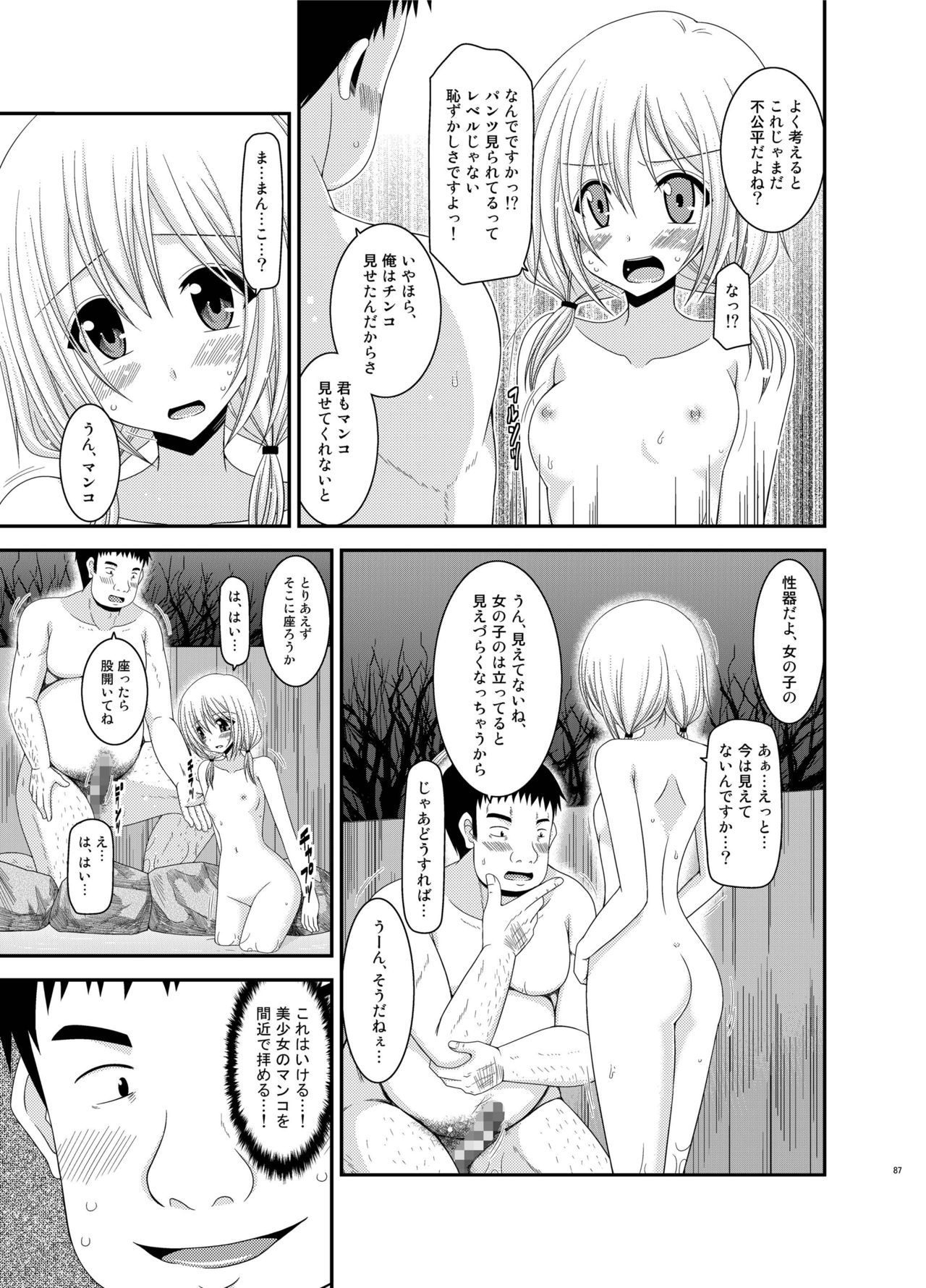 [valssu (茶琉)] 露出少女日記総集編2冊目 [DL版]