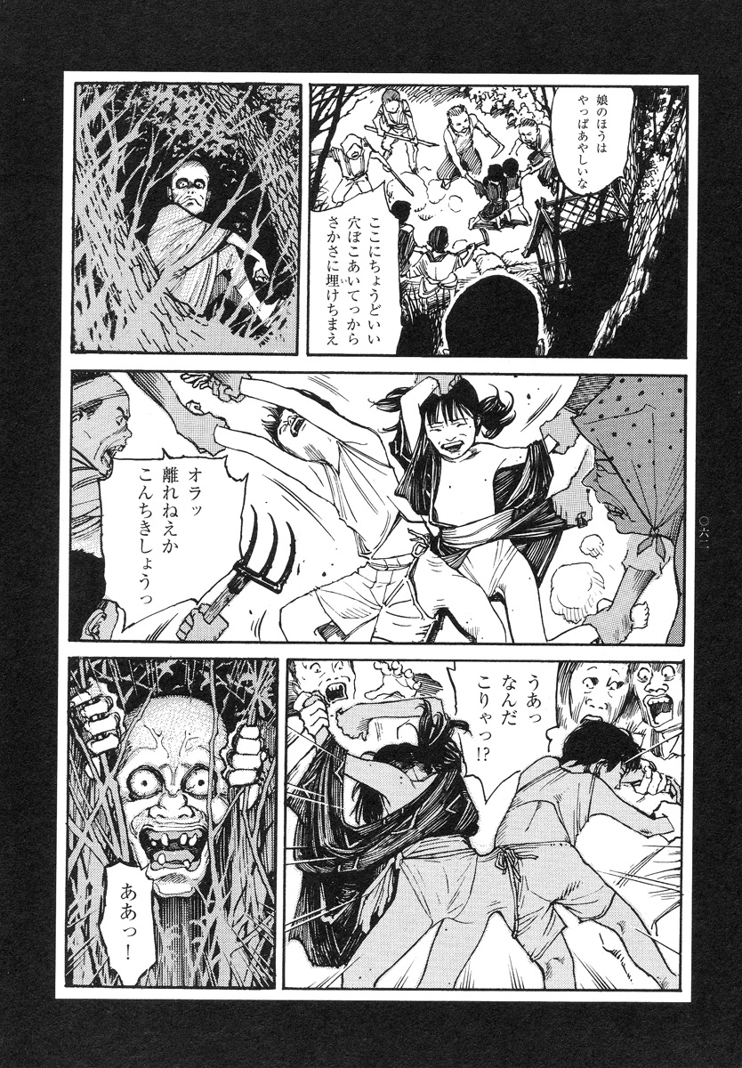 【大越幸太郎】結合双生児