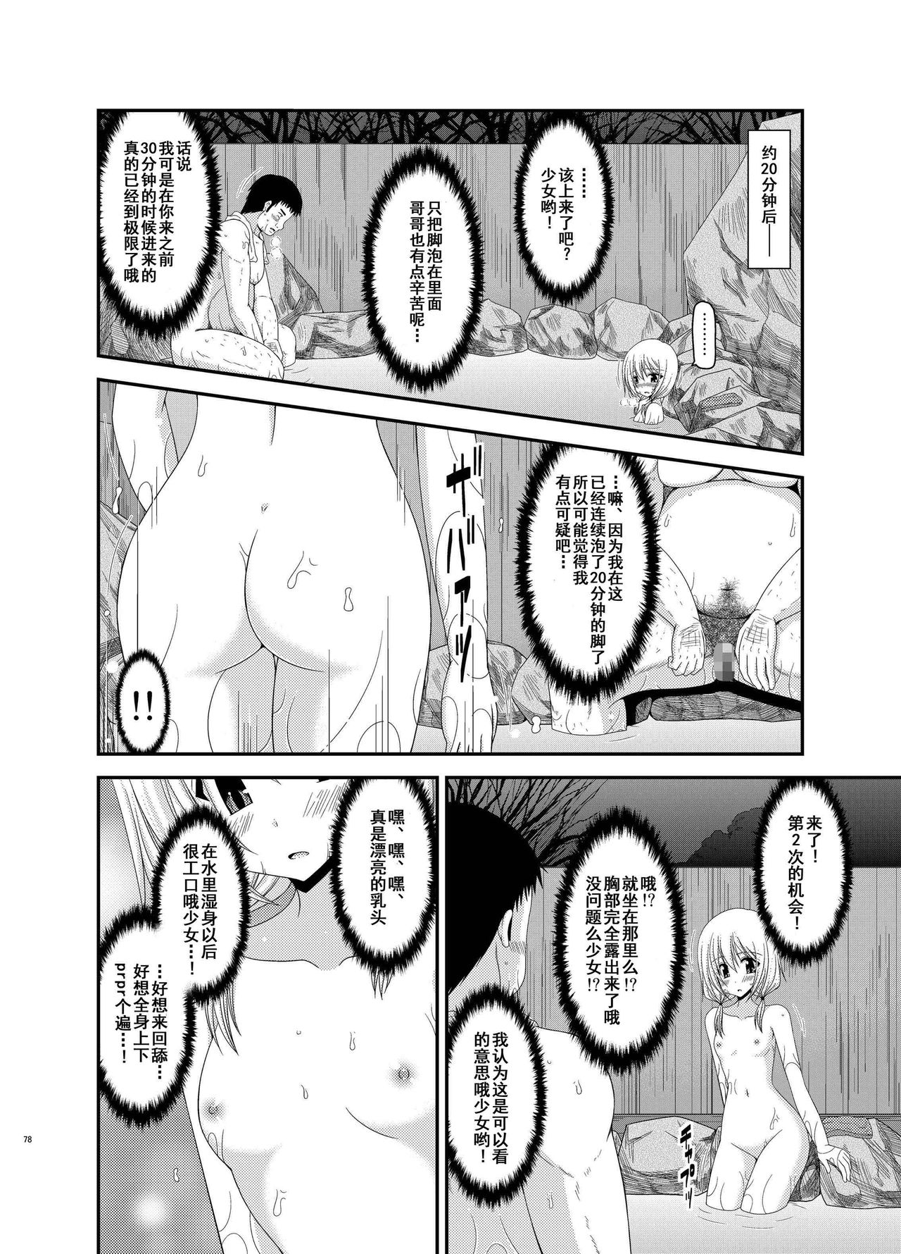 [valssu (茶琉)] 露出少女日記総集編2冊目 [中国翻訳] [DL版]